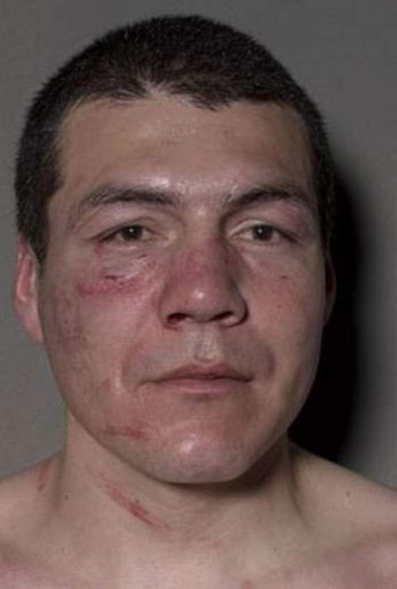 Boxeadores Antes Y Despues dela Pelea Boxeadores Antes Y Despues dela Pelea
