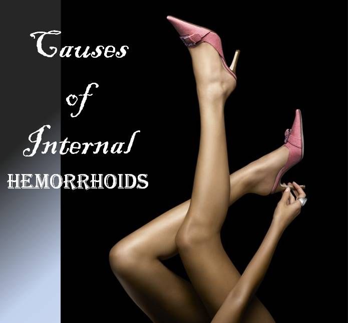 Causes of Internal Hemorrhoids photo CausesofInternalHemorrhoids_zpse9c0a9e7.jpg