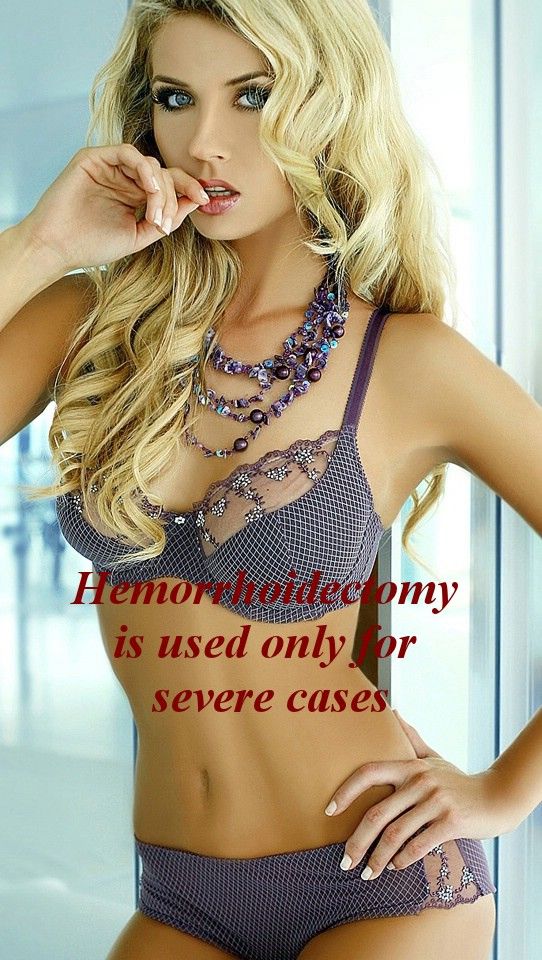 hemorrhoidectomy only for severe cases photo pic12hemorrhoidectomyonlyforseverecases_hemroids