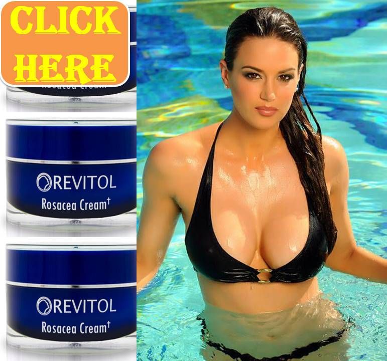 Revitol Rosacea Cream photo pic1RevitolRosaceaCream_zps0dab63d0.jpg